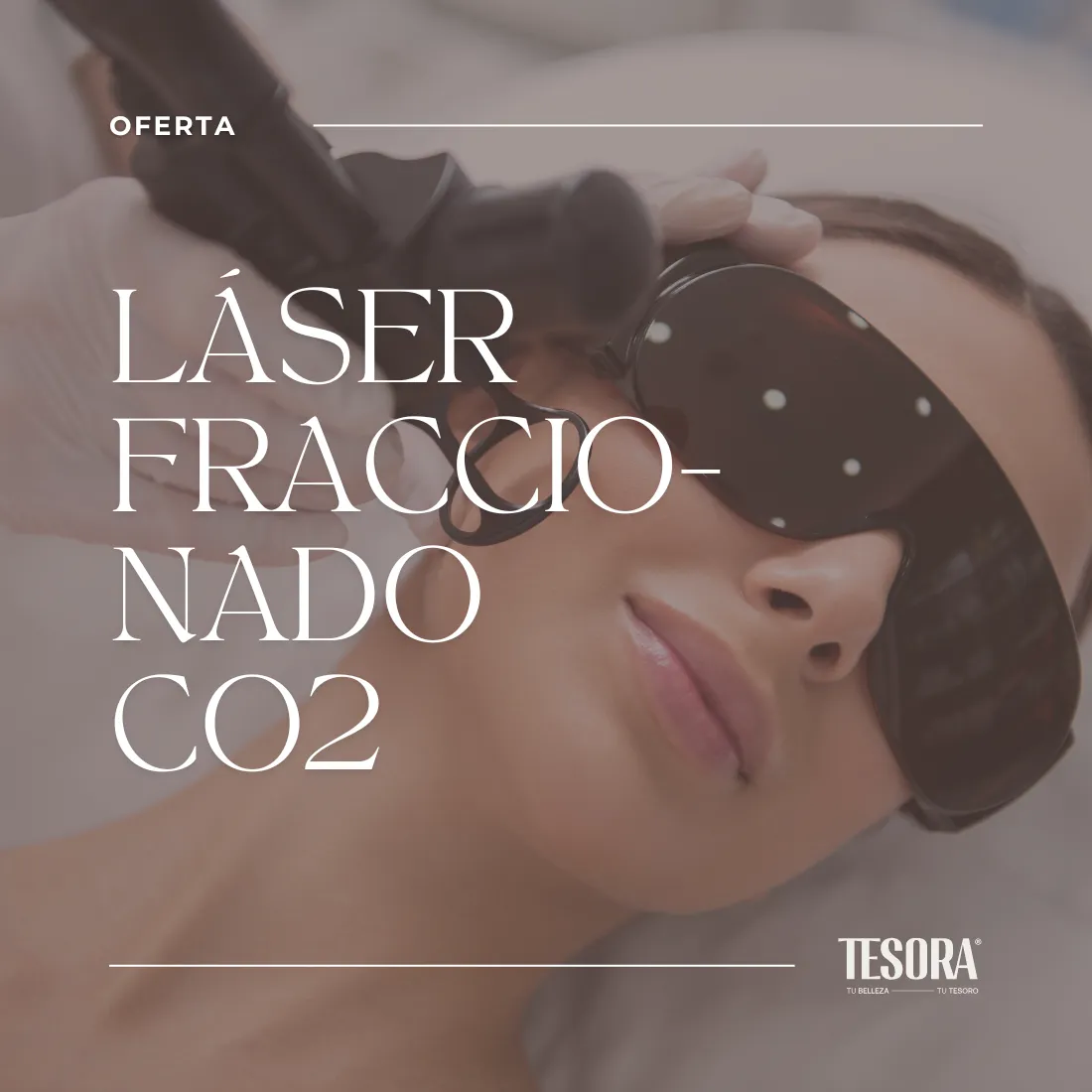 Láser CO2 fraccionado en San Fernando, Cádiz
